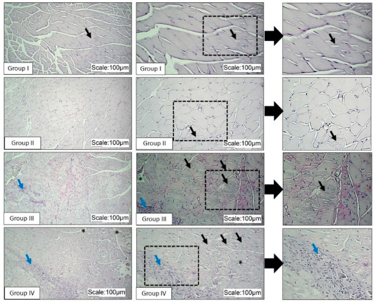 Evaluation of Creatine Monohydrate Supplementation on the Gastrocnemius Muscle of Mice with Muscular Dystrophy: A Preliminary Study.