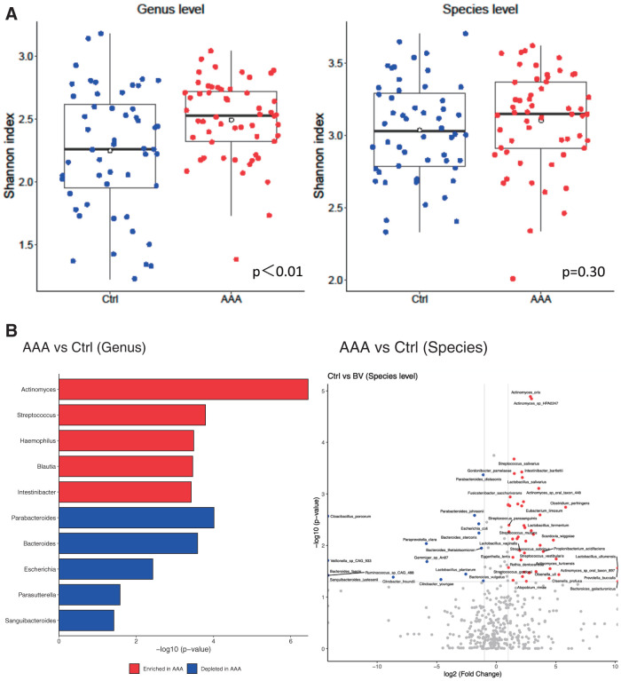 Metagenomic Analysis of Gut Microbiota for Abdominal Aortic Aneurysm.