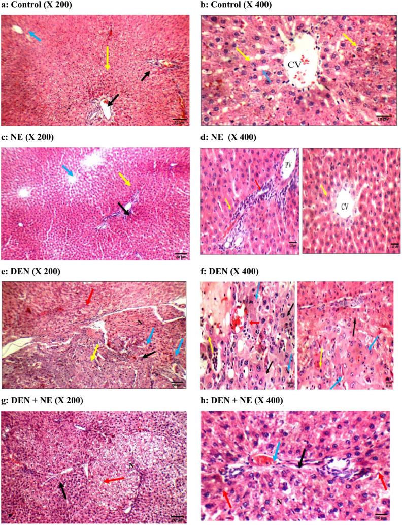 <i>Washingtonia robusta</i> H. Wendl Leaf Metabolites Potentiate the Radiosensitivity of Hepatocellular Carcinoma Through Ki67 and PARP Inhibition.
