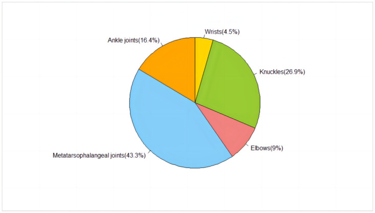 Evaluation of surgical treatment of gout-A retrospective study on 28 cases with tophi.