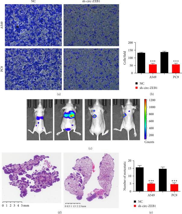circ-ZEB1 Enhances NSCLC Metastasis and Proliferation by Modulating the miR-491-5p/EIF5A Axis.