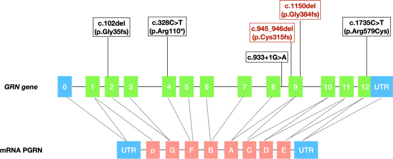 Frontotemporal Dementia in Russia: Genetic Structure, Phenotypic Diversity, and Diagnostic Biomarkers.
