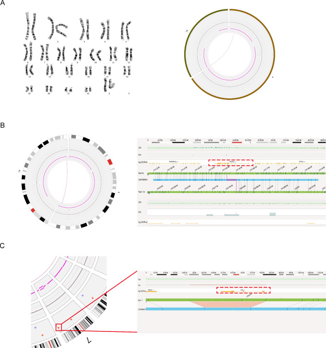 Optical genome mapping to decipher the chromosomal aberrations in families seeking for preconception genetic counseling.