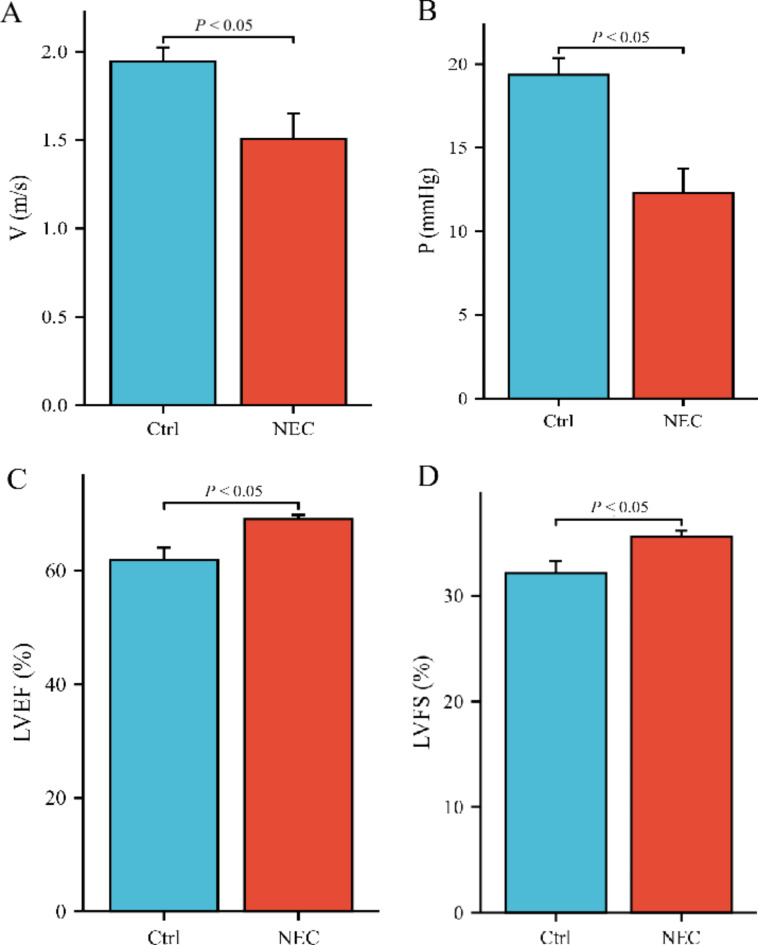 Clinical value of quantitative echocardiographic features in preterm infants with necrotizing enterocolitis.