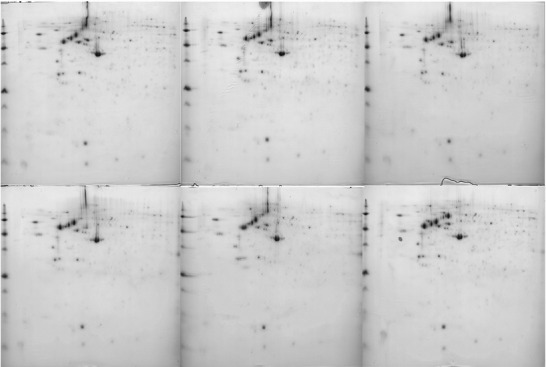 Proteomic Analysis of Fibroblasts Exposed to Resin Composite Release.