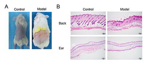 Restorative effects of camellia oil on the skin-barrier function in a model of DNCB-induced atopic dermatitis.