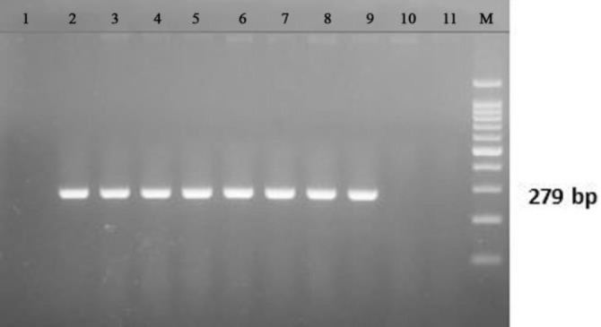 Molecular detection of the <i>Escherichia coli heme-utilization gene A</i> virulence factor in <i>E. coli</i> isolated from the feces of horses in Sumbawa island, Indonesia.