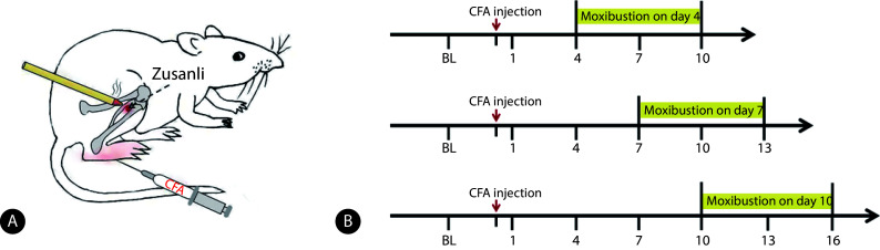 [Optimal Timing of Moxibustion Intervention for Anti-inflammatory and Analgesic Effects Based on a Chronic Inflammatory Pain Model].