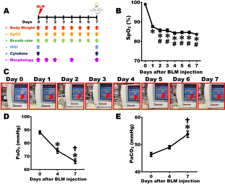 An animal model of severe acute respiratory distress syndrome for translational research.