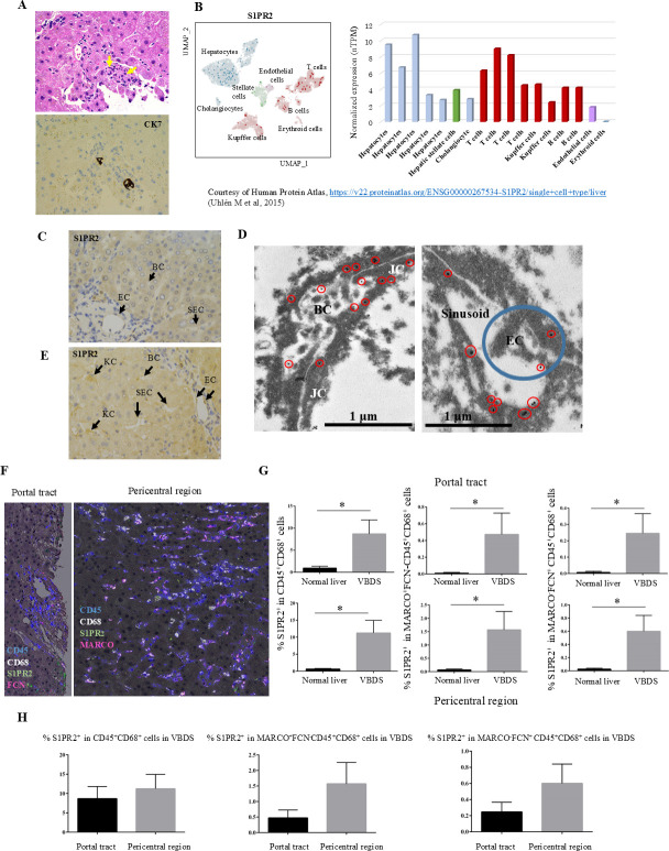 Activation of S1PR2 on macrophages and the hepatocyte S1PR2/RhoA/ROCK1/MLC2 pathway in vanishing bile duct syndrome.