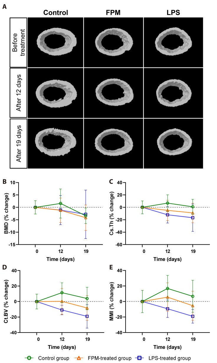 Fine particulate matter induces osteoclast-mediated bone loss in mice.