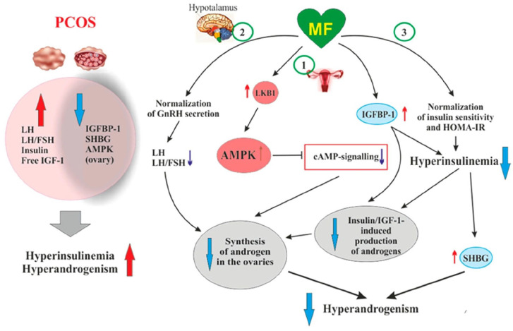 Update on the therapeutic role of metformin in the management of polycystic ovary syndrome: Effects on pathophysiologic process and fertility outcomes.
