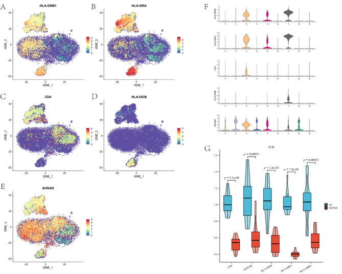 Combining machine learning and single-cell sequencing to identify key immune genes in sepsis.