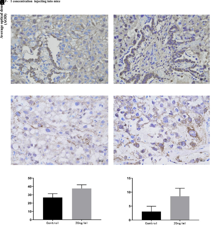 Effect of Exogenous of Transforming Growth Factor-β1 on Pregnancy Outcome in Mice with Recurrent Pregnancy Loss by Persistent Enhancement of Placental Tissue Indoleamine 2,3-Dioxygenase Expression.