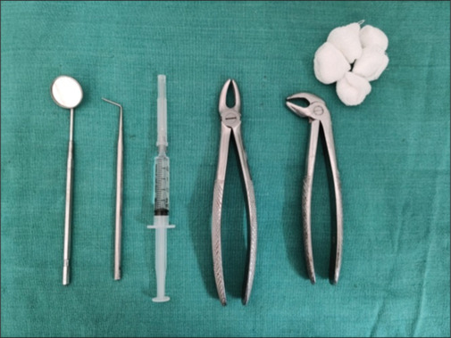 Evaluation of analgesic efficacy of transdermal patch versus oral diclofenac tablets in orthodontic patients undergoing multiple premolar extractions - A crossover study.