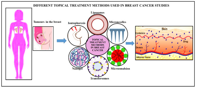 A Comprehensive Review on Current Knowledge and Future Potential of Topical Therapies in Breast Cancer Treatment.