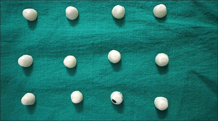 Evaluation of marginal accuracy of polyetheretherketone and zirconia copings fabricated using computer-aided design/computer-aided manufacturing technique: An in vitro study.