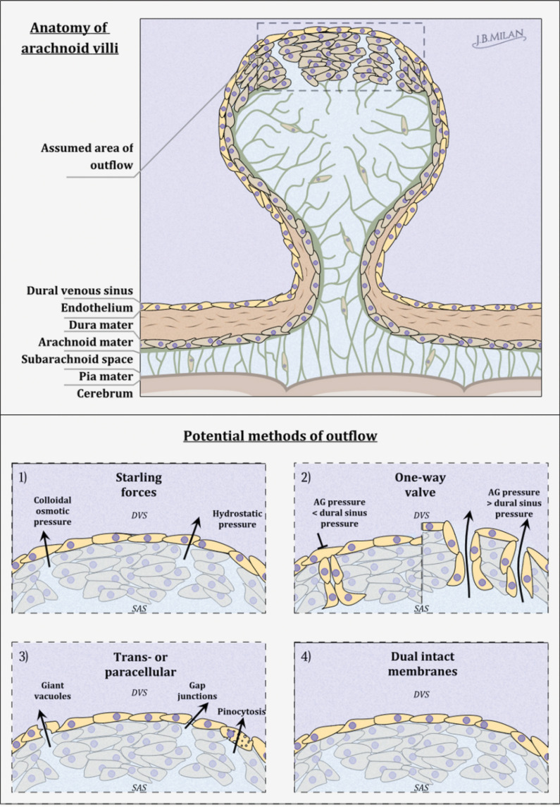 Intracranial Air Absorption through Arachnoid Granulation: New Considerations from Transsphenoidal Surgery and Implications for Neurofluid Dynamics.