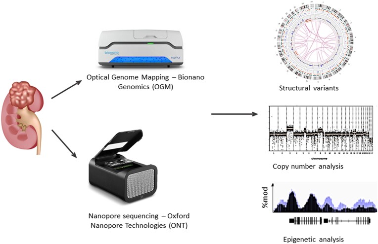 Long-read structural and epigenetic profiling of a kidney tumor-matched sample with nanopore sequencing and optical genome mapping.