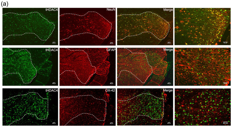 SGK1-HDAC4-HMGB1 signaling pathway in the spinal cord dorsal horn participates in diabetic neuropathic pain.