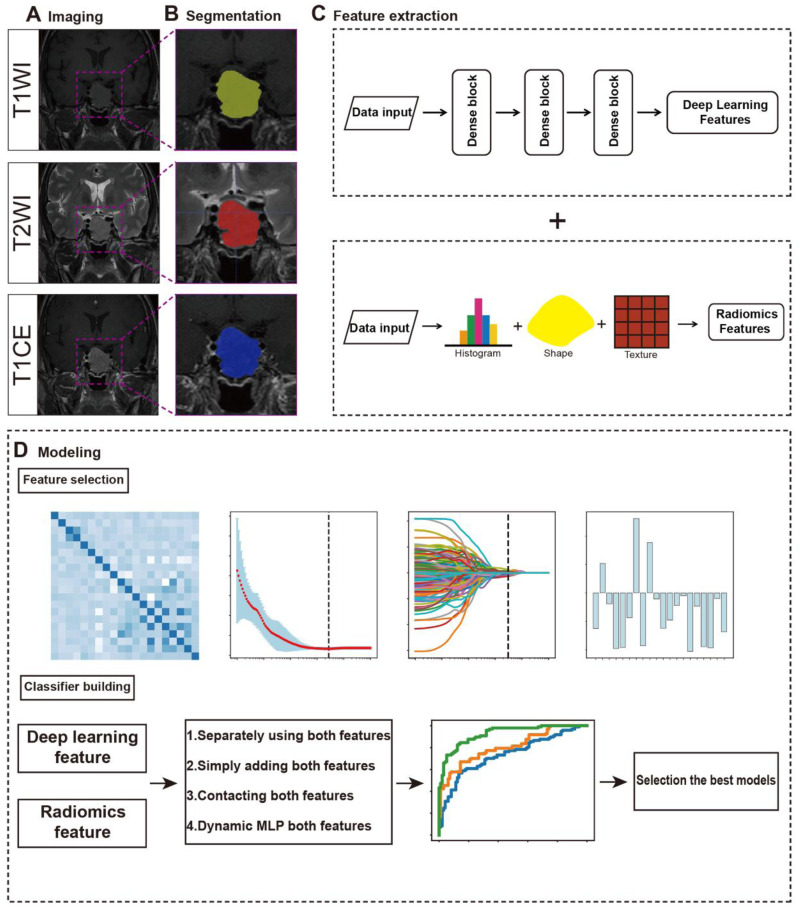 Multimodal Model for Non-Invasive Detection of DRD2, SSTR2 and ESR1 Receptor Profiling in Pituitary Neuroendocrine Tumors: A Retrospective Study.