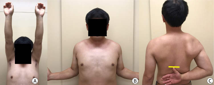 Conservative treatment of older adult patients with shoulder diseases: a narrative review.