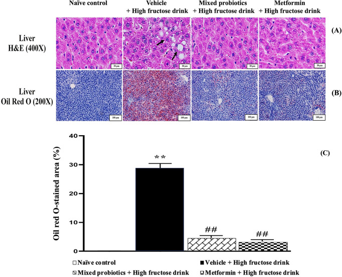 Administration of a probiotic supplement attenuates nonalcoholic fatty liver disease by reducing hepatic lipid accumulation, oxidative stress, and inflammation.