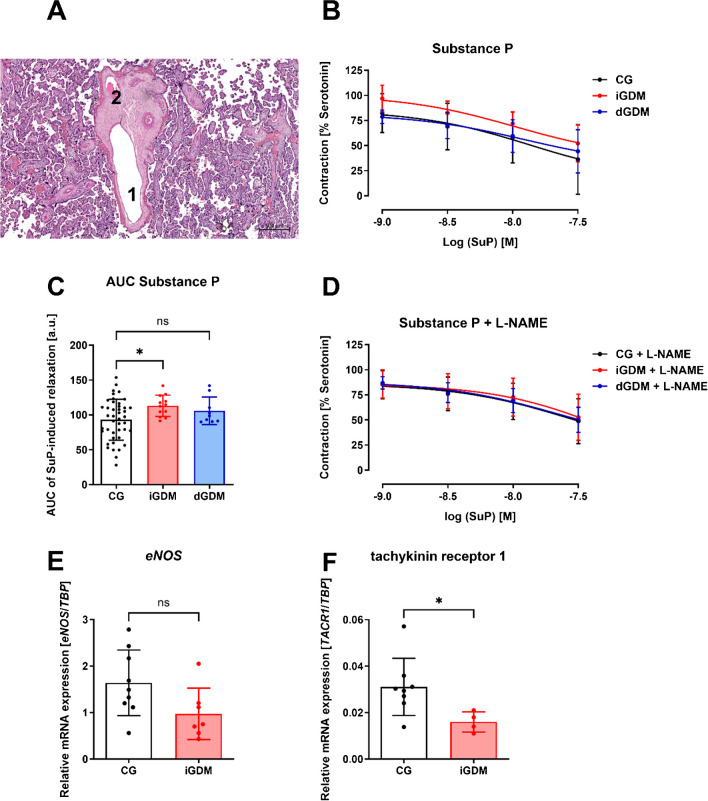 Characterization of human placental fetal vessels in gestational diabetes mellitus.
