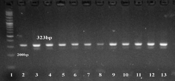 Prevalence and molecular characterization of resistant <i>Staphylococcus aureus</i> strains in bulk milk tanks of dairy cattle in Northern Egypt.