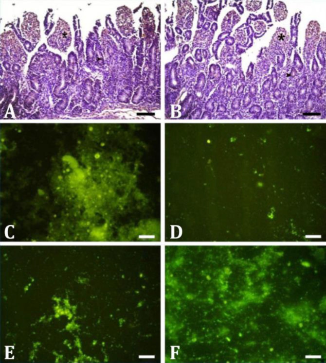 Diagnosis of bovine group A rotavirus, bovine coronavirus, <i>Escherichia</i> <i>coli</i> K99, <i>Cryptosporidium</i> spp., <i>Giardia</i> spp. in calf diarrhea with one-step duplex RT-PCR: histopathological and immunochromotographic methods.
