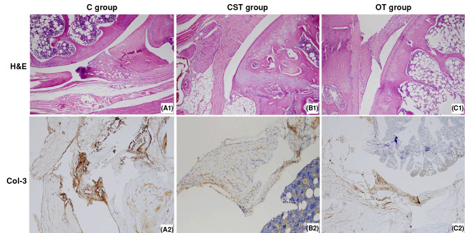 Efficacy of ozone therapy in the treatment of frozen shoulder in rats: An experimental study.