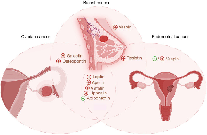 Breast cancer shares many epidemiological, lifestyle, and local hormonal and metabolic underpinnings with endometrial and ovarian cancer: a narrative review.