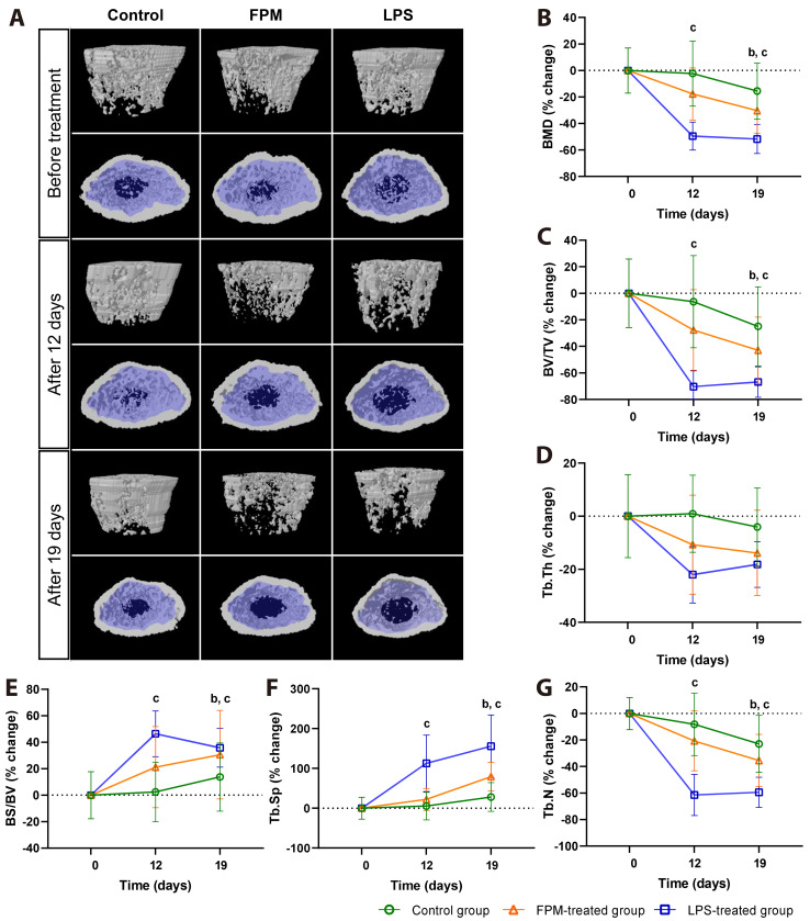 Fine particulate matter induces osteoclast-mediated bone loss in mice.