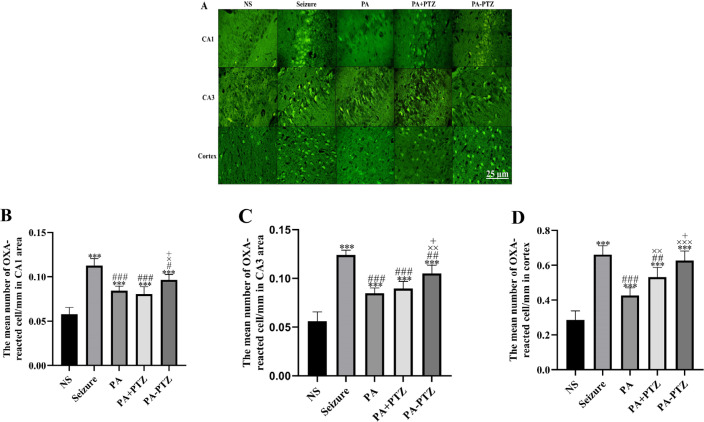 The Effect of Physical Activity on the Orexin and Brain-derived Neurotrophic Factor Expression on the Kindling Model of Epileptic Rats.