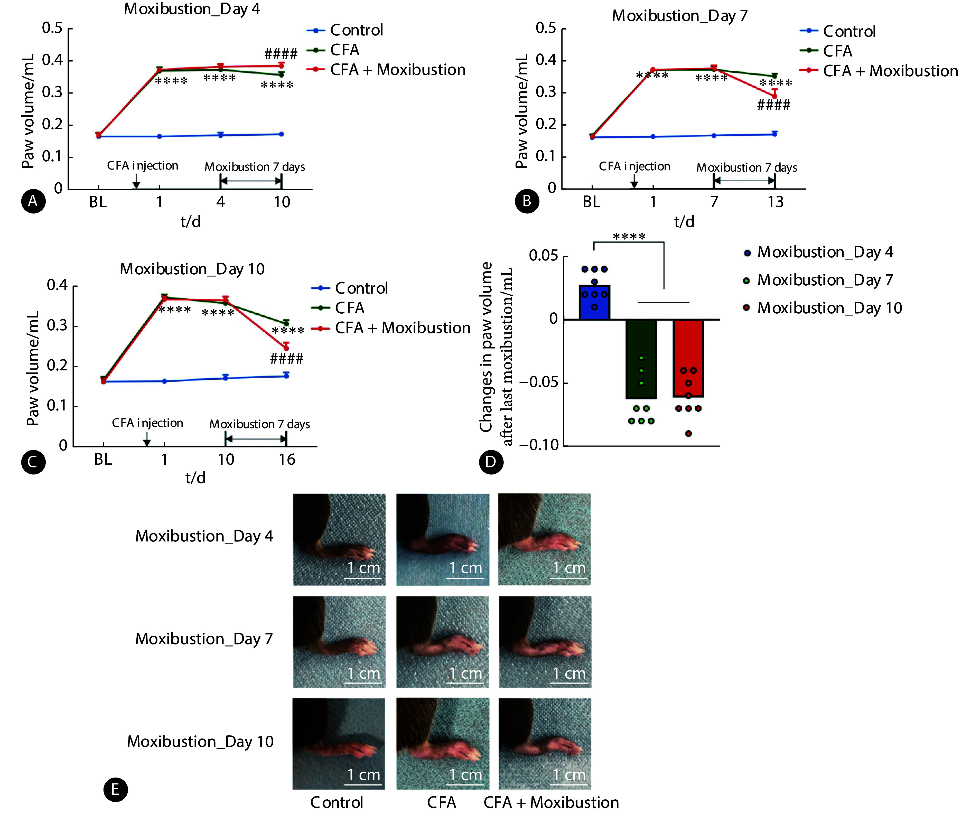 [Optimal Timing of Moxibustion Intervention for Anti-inflammatory and Analgesic Effects Based on a Chronic Inflammatory Pain Model].