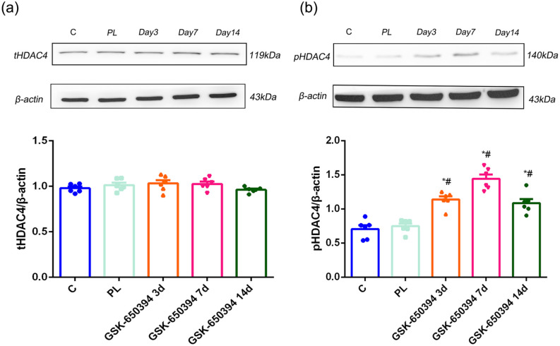 SGK1-HDAC4-HMGB1 signaling pathway in the spinal cord dorsal horn participates in diabetic neuropathic pain.