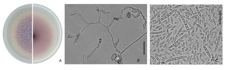 The Toxin-Producing Ability of Fusarium Proliferatum Strains Isolated from Grain.
