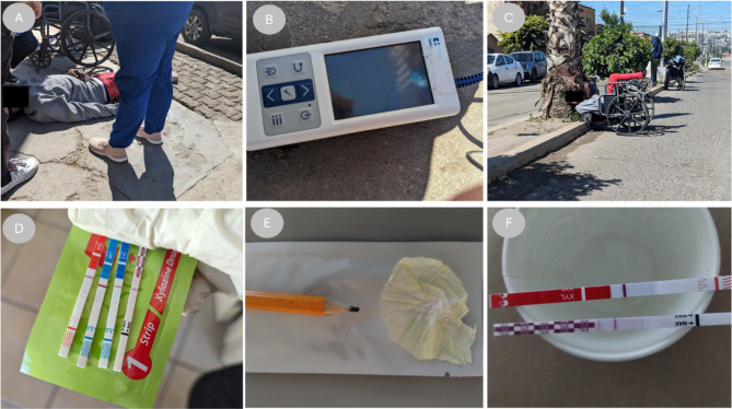 Managing xylazine-involved overdoses in a community harm reduction setting: lessons from Tijuana, Mexico.