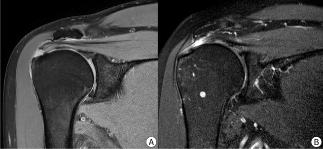 Conservative treatment of older adult patients with shoulder diseases: a narrative review.