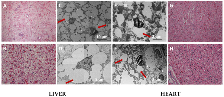 Sudden Death of a Four-Day-Old Newborn Due to Mitochondrial Trifunctional Protein/Long-Chain 3-Hydroxyacyl-CoA Dehydrogenase Deficiencies and a Systematic Literature Review of Early Deaths of Neonates with Fatty Acid Oxidation Disorders.