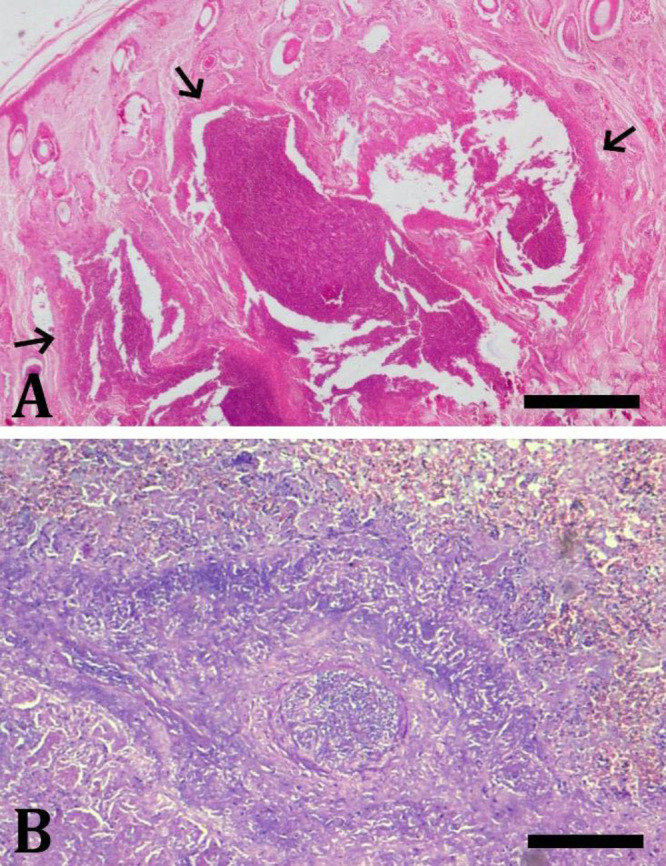 An outbreak of Fusobacterium necrophorum associated foot rot in a herd of four-horned antelope (<i>Tetracerus quadricornis</i>) in India.