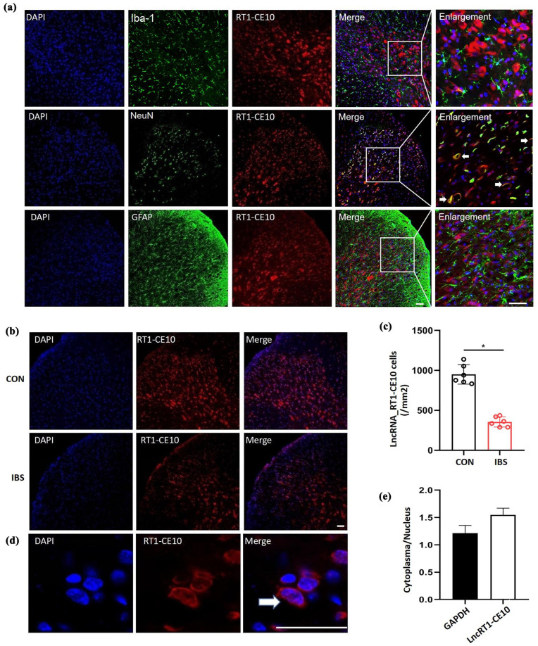 The involvement of spinal lncRNA RT1-CE10 in chronic functional visceral pain.