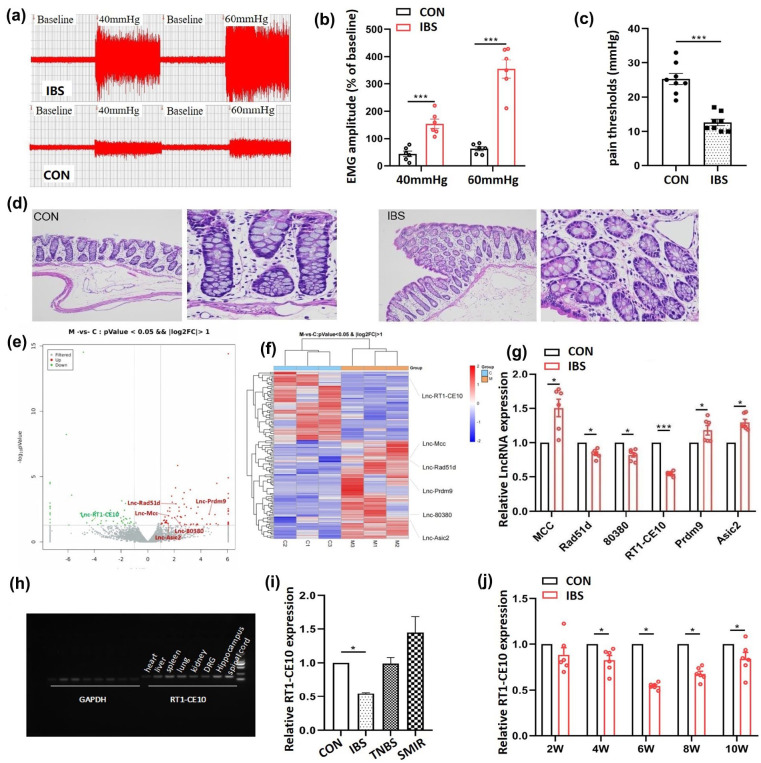 The involvement of spinal lncRNA RT1-CE10 in chronic functional visceral pain.