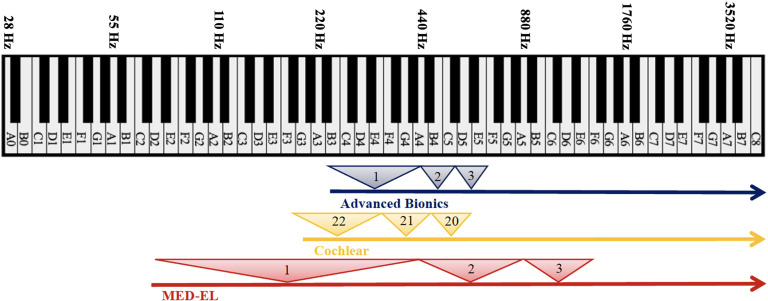 Evaluating Selective Apical Electrode Deactivation for Improving Cochlear Implant Outcomes.