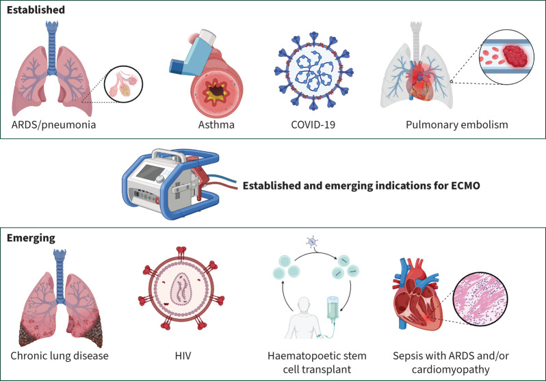 Extracorporeal membrane oxygenation for adults with respiratory failure secondary to cardiorespiratory disease: evolving indications and clinical practice.