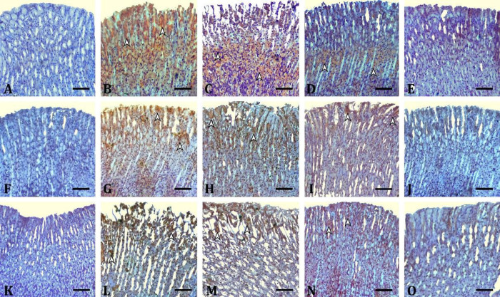 Effect of <i>Gundelia tournefortii</i> extract on diabetic gastropathy: involvement of inflammation, apoptosis, oxidative stress, and histopathology.