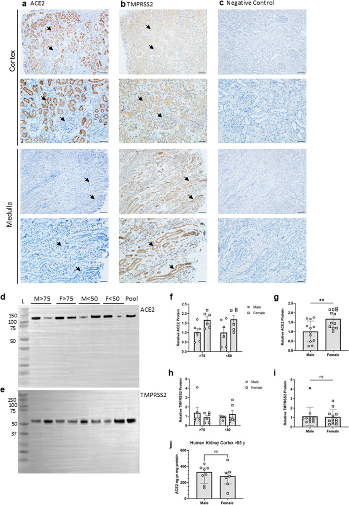 ACE2 and TMPRSS2 in human kidney tissue and urine extracellular vesicles with age, sex, and COVID-19.