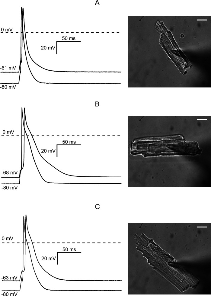 Distinct effects of obesity and diabetes on the action potential waveform and inward currents in rat ventricular myocytes.