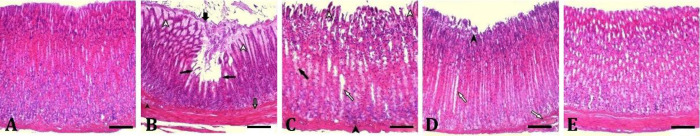 Effect of <i>Gundelia tournefortii</i> extract on diabetic gastropathy: involvement of inflammation, apoptosis, oxidative stress, and histopathology.