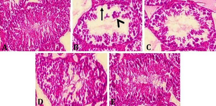 Provitamin A carotenoid (β-cryptoxanthin) ameliorated testicular ischemia-reperfusion injury in mature rats.